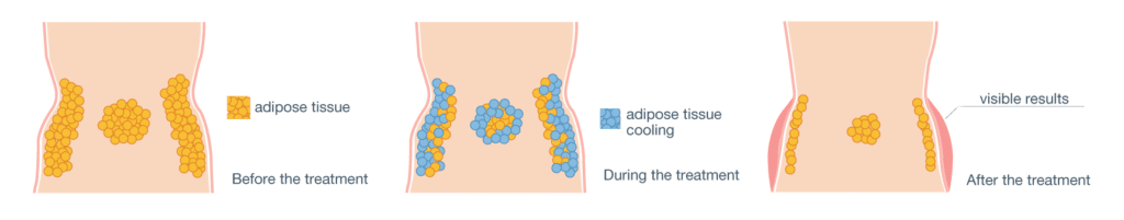 The science of Cooltech