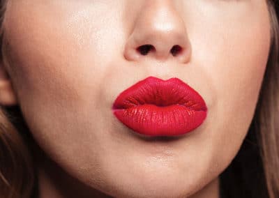 Lip Service: Preventing Skin Cancer On Your Kissers