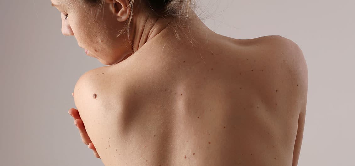 Woman looking over her shoulder checking her skin