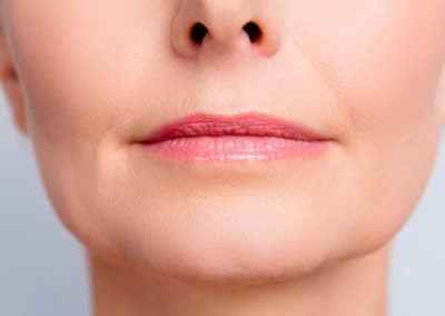 5 Ways to Combat Ageing Lips