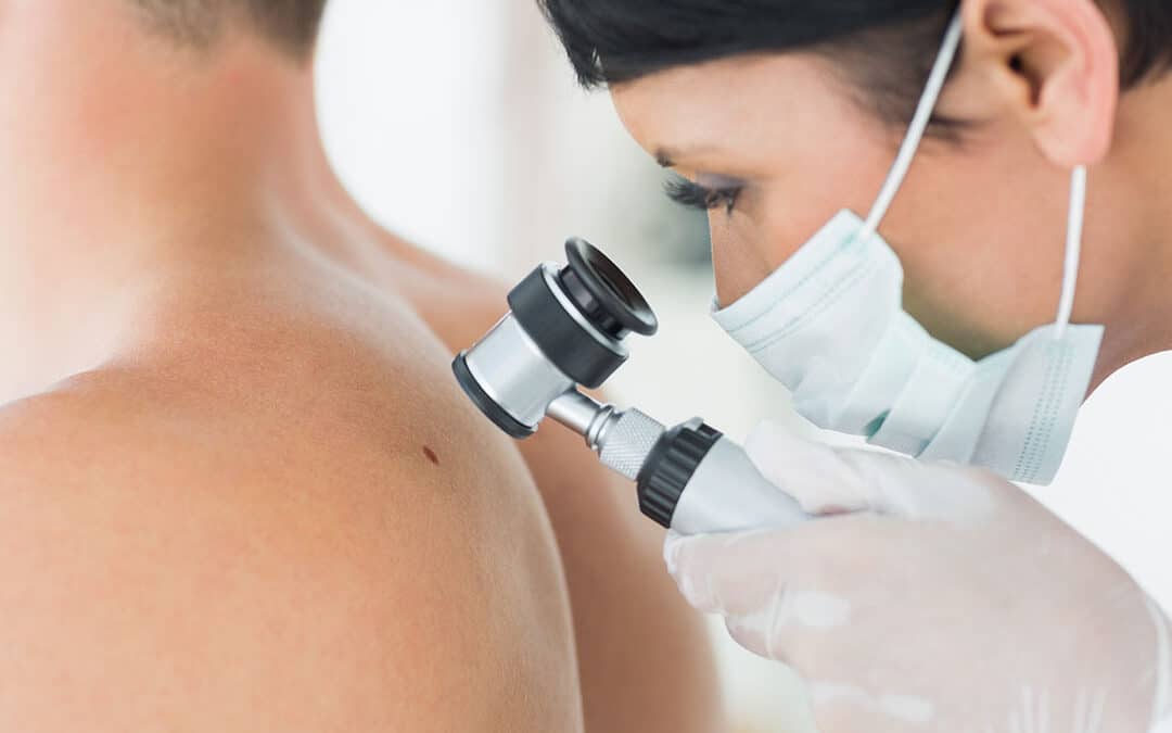 Falsies: Debunking Myths about Skin Doctors