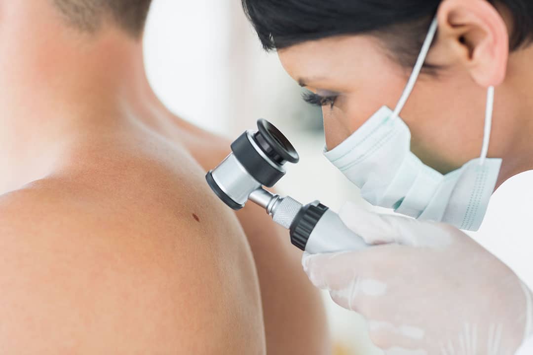 Woman doing a skin check on a male patient