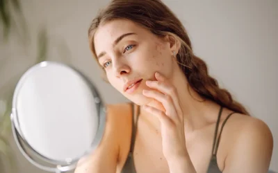 Why Your Complexion Turns Against You