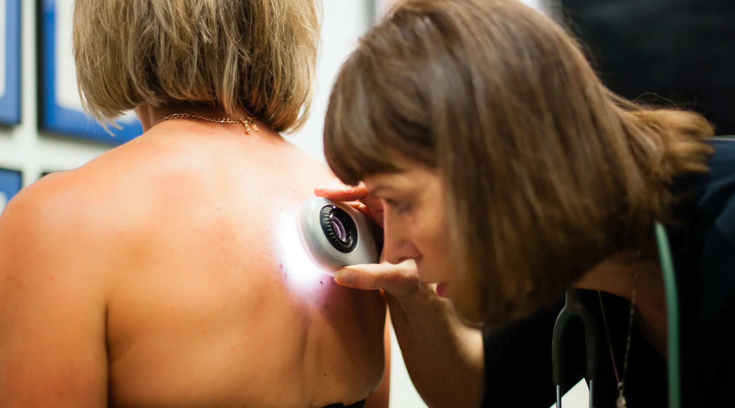 patient receiving a skin cancer check from Dr Susan Austin