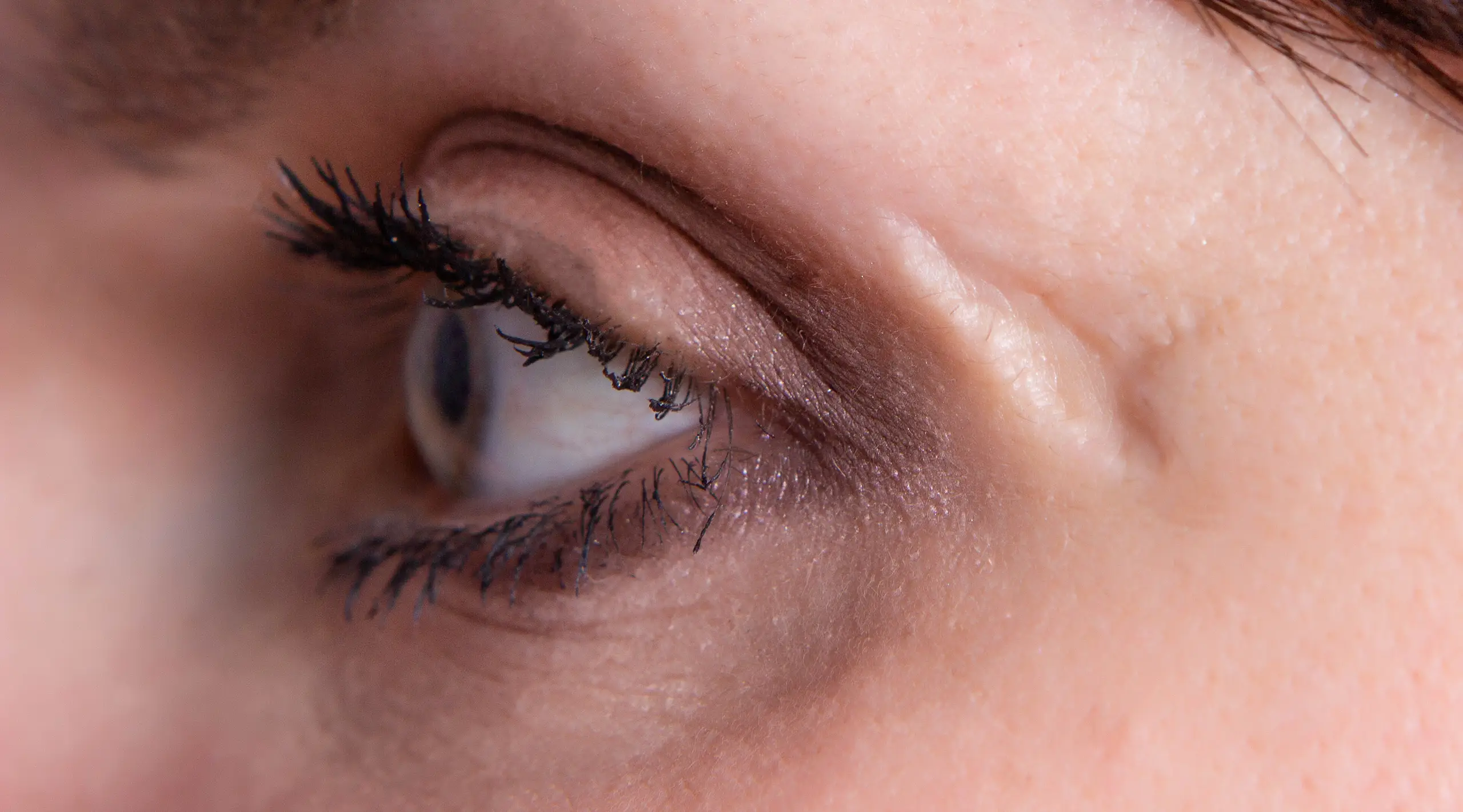 Closeup of a woman with a scar next to her eye