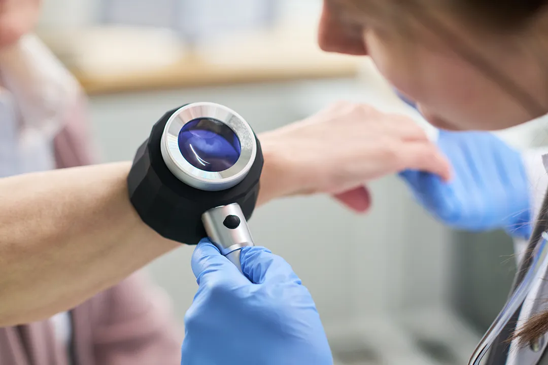 Why PDT Can Treat More Than the Sun Damage You Can See Patient being checked for skin cancer and sun damage